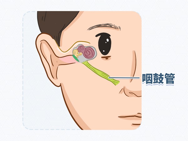 耳疼、耳闷、流脓--化脓性中耳炎的三大症状1.jpg