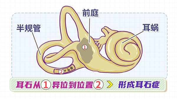 突然之间天旋地转,这是怎么了?.jpg