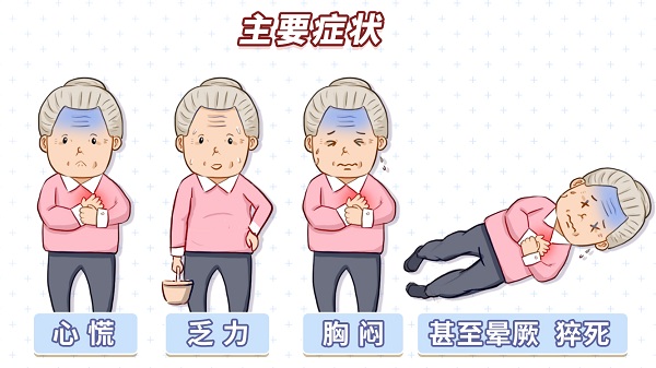 严重的心慌、乏力、胸闷,可能是“室速”在作怪!1.jpg