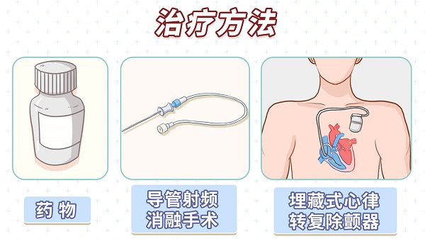 严重的心慌、乏力、胸闷,可能是“室速”在作怪!2.jpg