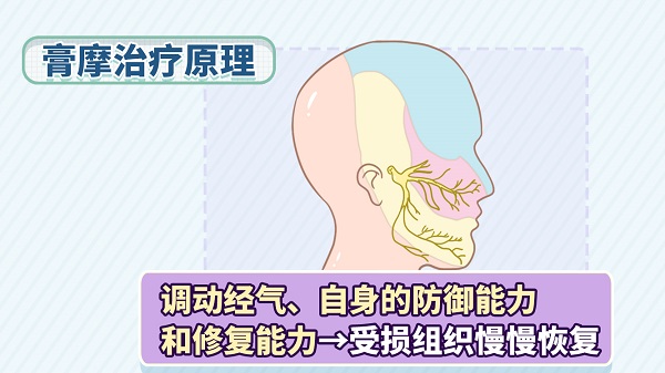 不动刀、不用针、不吃药——三叉神经痛的膏摩治疗1.jpg