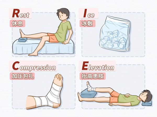 崴脚后怎么紧急处理？有必要去医院吗？1.jpg