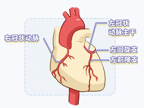 冠心病是怎么形成的?治疗方法有哪些?